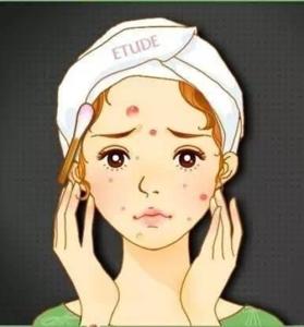 我的精彩人生被毁掉都是因为牛皮癣