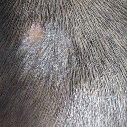 患有牛皮癣疾病会影响患者们的心理吗