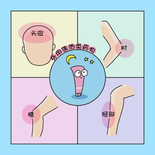 银屑病患者在就诊中出现的误区有哪些