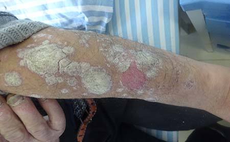 身心同治牛皮癣街边广告不要信