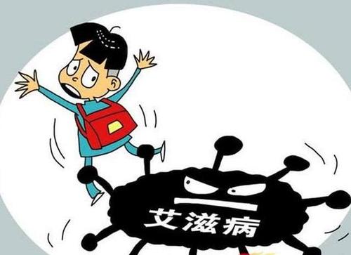 牛皮癣是艾滋病的症状吗