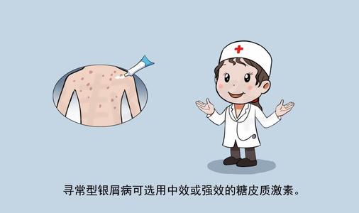 银屑病发病晚期很可怕早发现早治疗