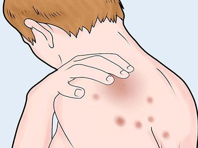 魔鬼身材但是却长了一背的牛皮癣