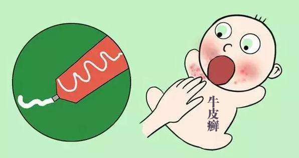 宝宝患上牛皮廯怎么治在线求解答
