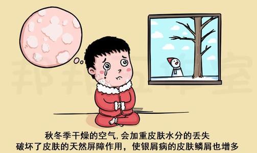 银屑病的治疗成本与什么有关大概需要多少