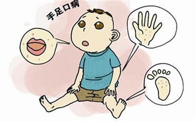 牛皮癣用艾叶煮水洗澡好吗