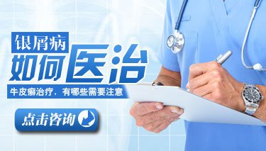 银屑病是怎么引起的