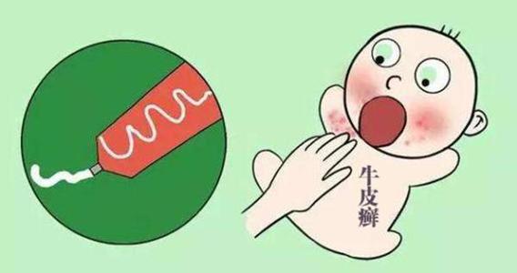 牛皮癣患者服药期间需要忌口的事项有哪些