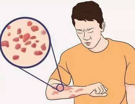 银魔伤皮肤,护理我在行