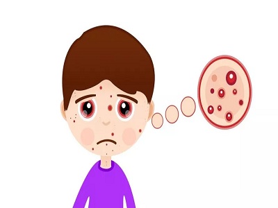 降服牛魔王高效激素药能用吗怎么用