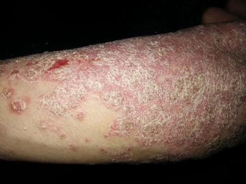 莫让银魔侵害了老年人晚年幸福生活