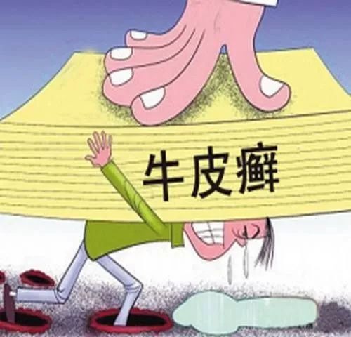 牛皮癣来袭心慌慌尽快确诊是关键