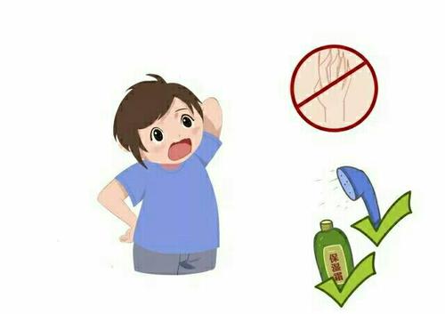 银屑病治疗多长时间才能实现康复