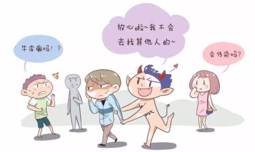 治疗银屑病前需要做的检查项目有哪些