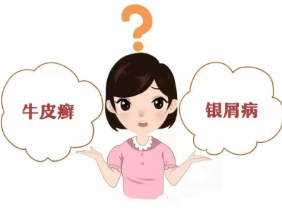 牛皮癣治疗服药期间为什么病情还蔓延