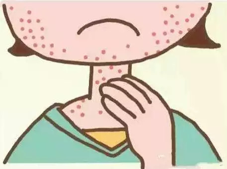 牛皮癣病人想跟上时尚新潮可不可以化妆