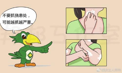 牛皮癣反复发作的原因是什么