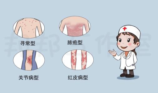 多种牛皮癣的不同形态特征是什么样