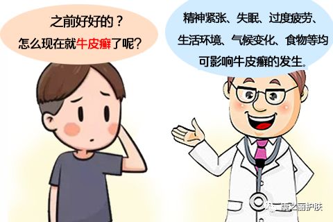 牛皮癣患者吃什么能够提高身体的抵抗力