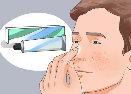 使用外用药治疗银屑病需要注意什么