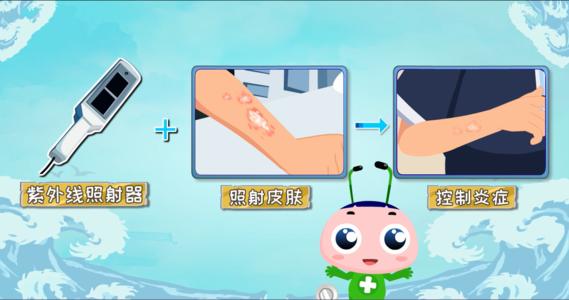 小孩子得银屑病怎么治疗